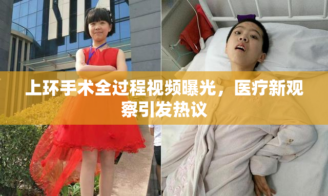 上环手术全过程视频曝光，医疗新观察引发热议