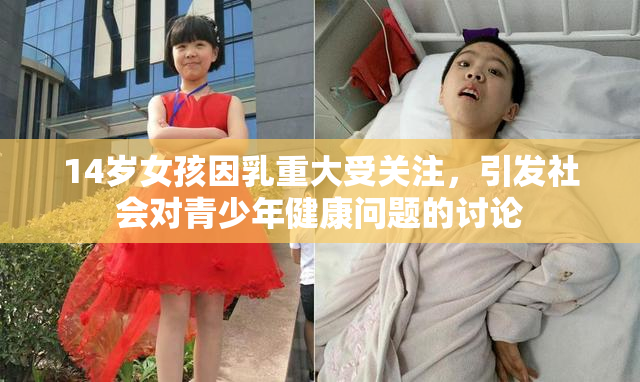 14岁女孩因乳重大受关注，引发社会对青少年健康问题的讨论