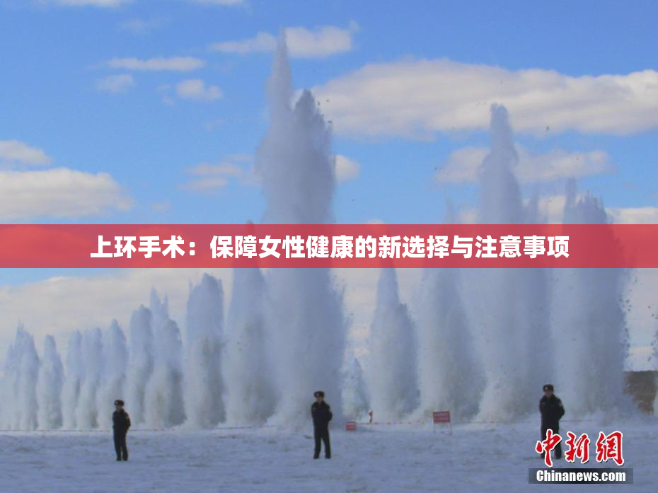 上环手术：保障女性健康的新选择与注意事项