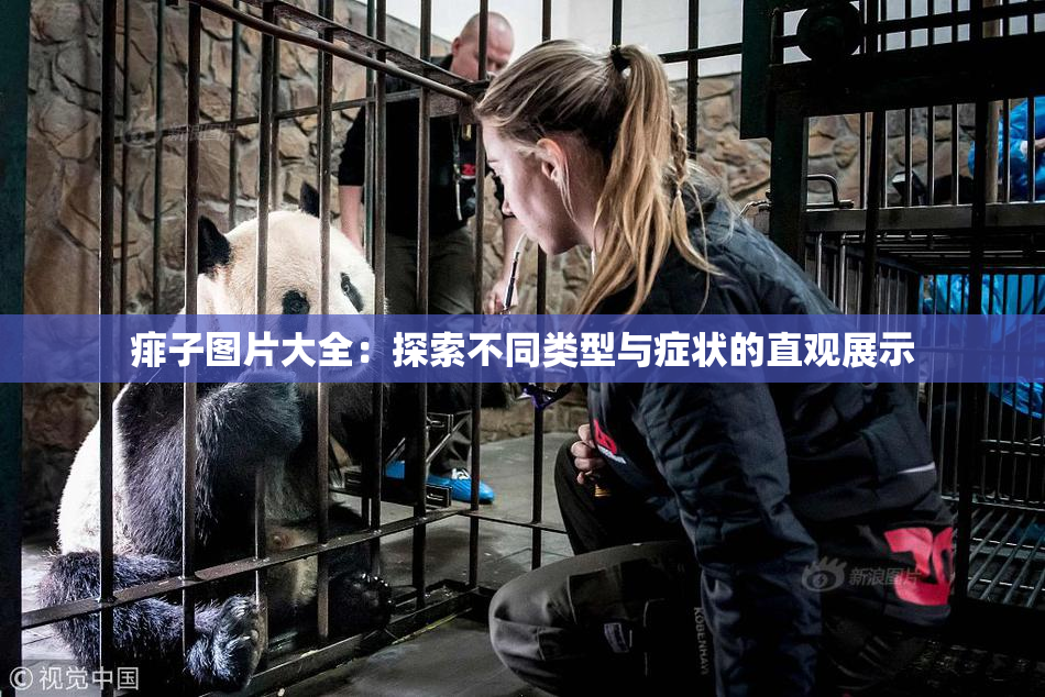 痱子图片大全：探索不同类型与症状的直观展示