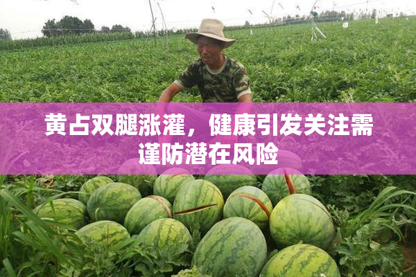 黄占双腿涨灌，健康引发关注需谨防潜在风险