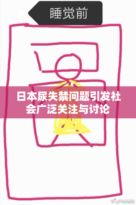 日本尿失禁问题引发社会广泛关注与讨论