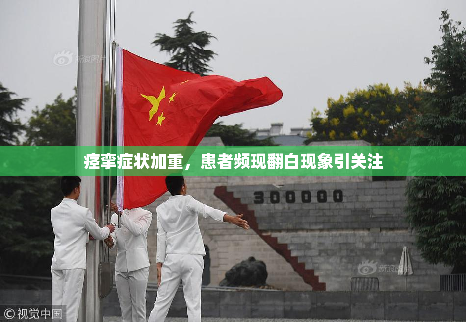 痉挛症状加重，患者频现翻白现象引关注