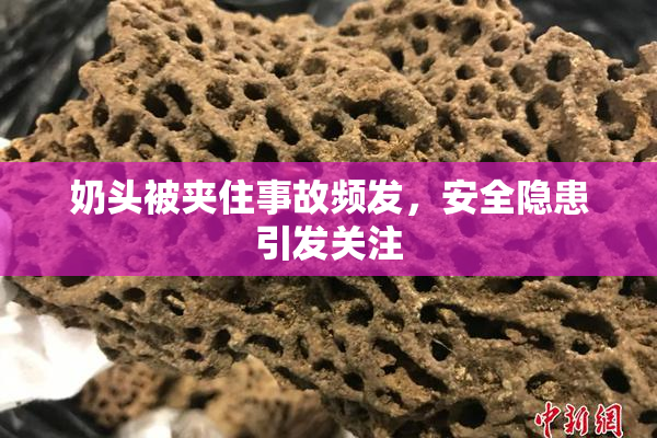 奶头被夹住事故频发，安全隐患引发关注