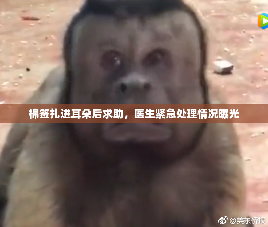 棉签扎进耳朵后求助，医生紧急处理情况曝光