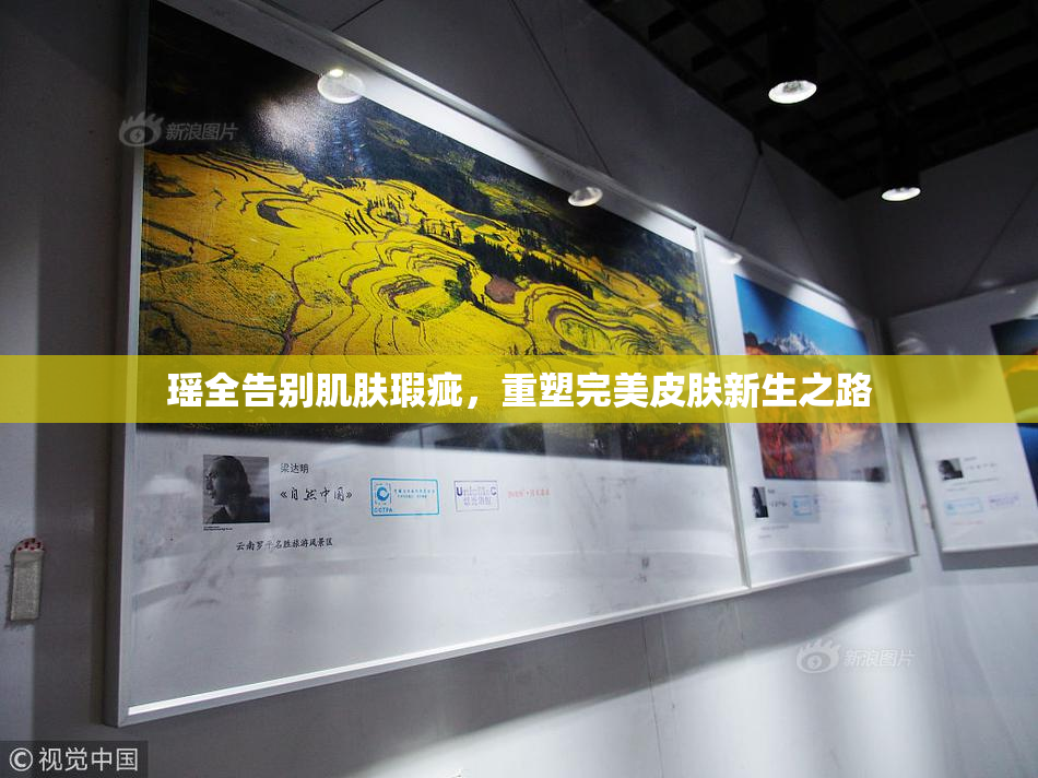 瑶全告别肌肤瑕疵，重塑完美皮肤新生之路