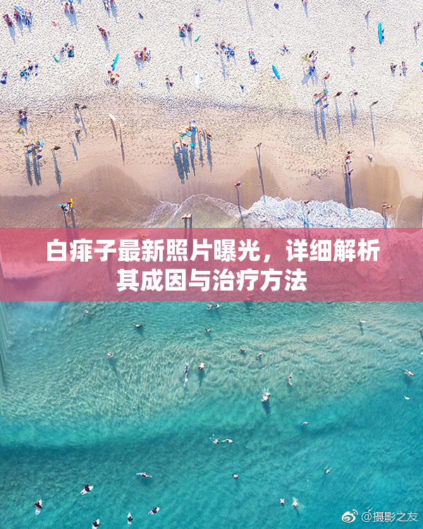 白痱子最新照片曝光，详细解析其成因与治疗方法