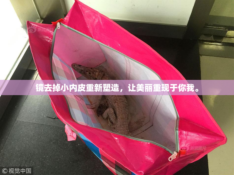 镜去掉小内皮重新塑造，让美丽重现于你我。