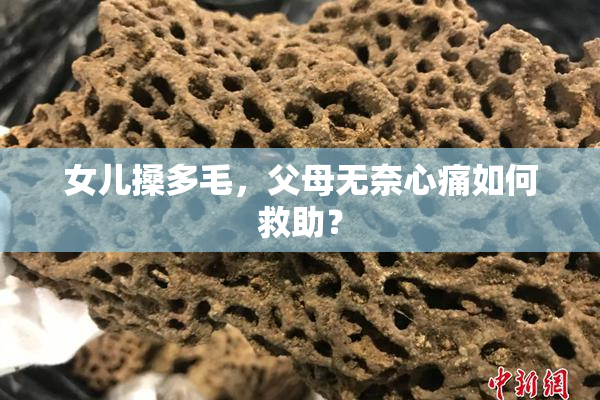 女儿搡多毛，父母无奈心痛如何救助？