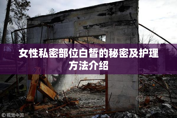 女性私密部位白皙的秘密及护理方法介绍