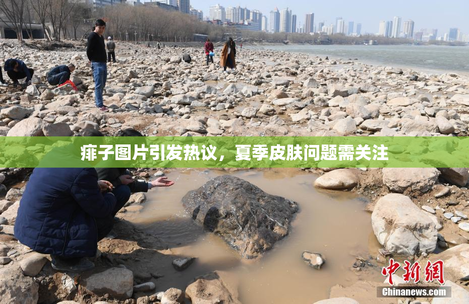 痱子图片引发热议，夏季皮肤问题需关注