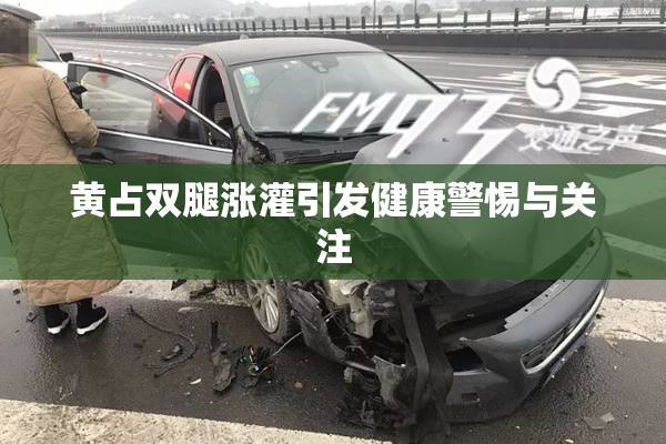 黄占双腿涨灌引发健康警惕与关注